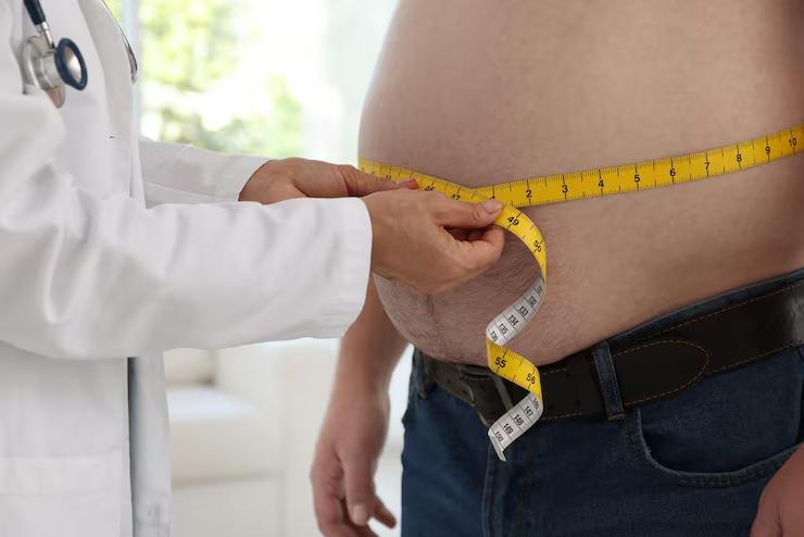 Avaliação e Acompanhamento para Cirurgia Bariátrica 